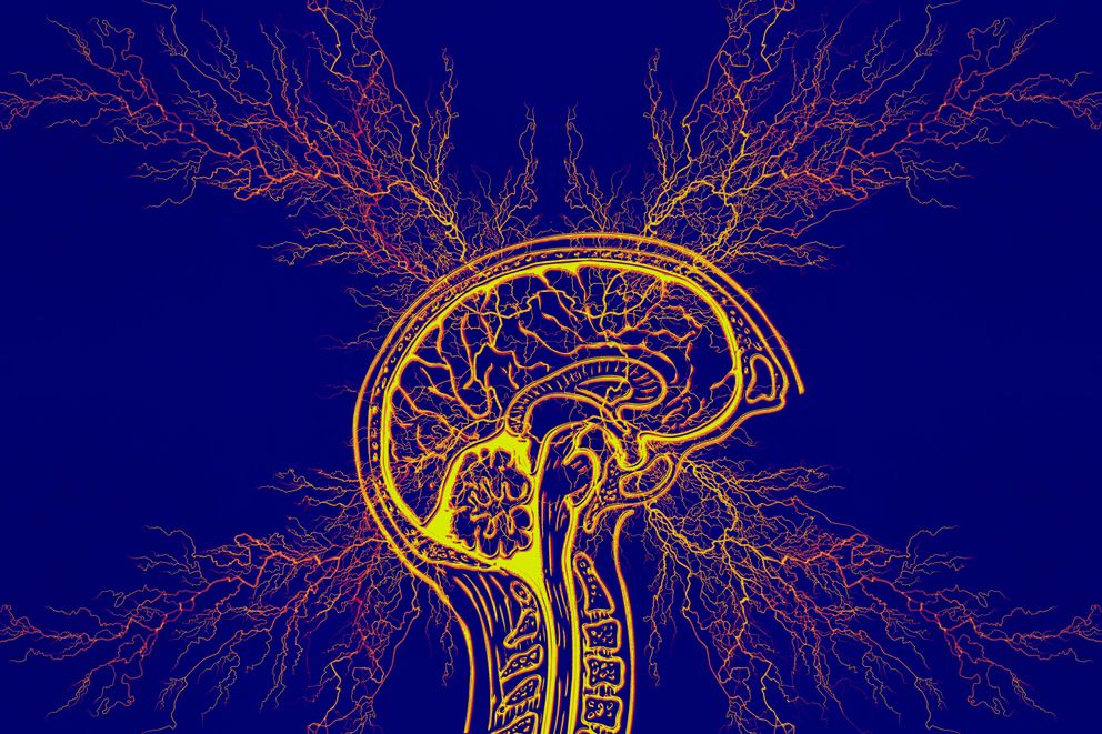 Best Diets for Epilepsy in Women 2024: Effective Nutritional Strategies A selection of meals from the best diets for epilepsy in women, featuring nutrient-rich ingredients tailored to enhance neurological health.